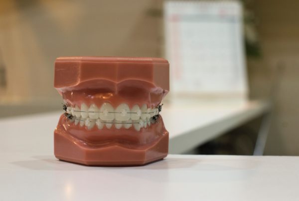 Buying a dental practice